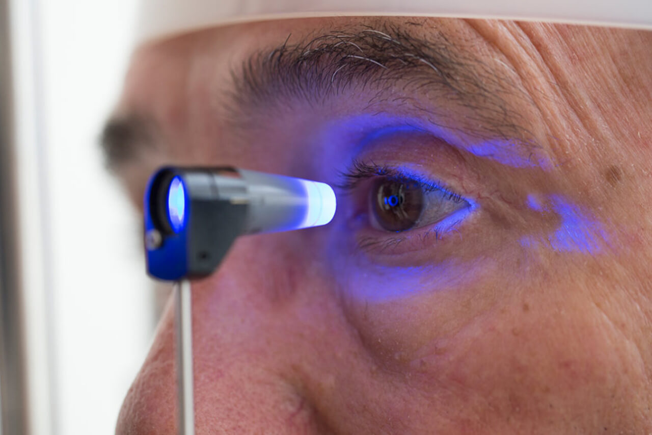 A imagem mostra um close-up de um exame oftalmológico sendo realizado em um paciente. O profissional de saúde está utilizando um equipamento com luz azul para examinar o olho do paciente. O foco está no olho do paciente, com o equipamento projetado para iluminar e observar detalhes da visão. A cena transmite a precisão e a tecnologia envolvidas nos exames oftalmológicos modernos.
