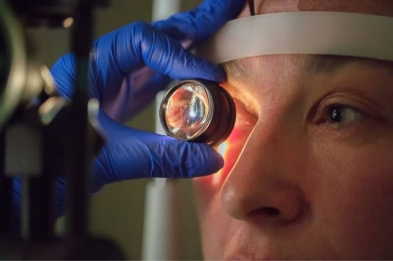 
Uma imagem composta mostrando um close-up de um olho humano com vasos sanguíneos visíveis na esclera vermelha, e uma inserção gráfica da retina. A inserção da retina mostra vasos sanguíneos ramificados e áreas de hemorragia ou dano.