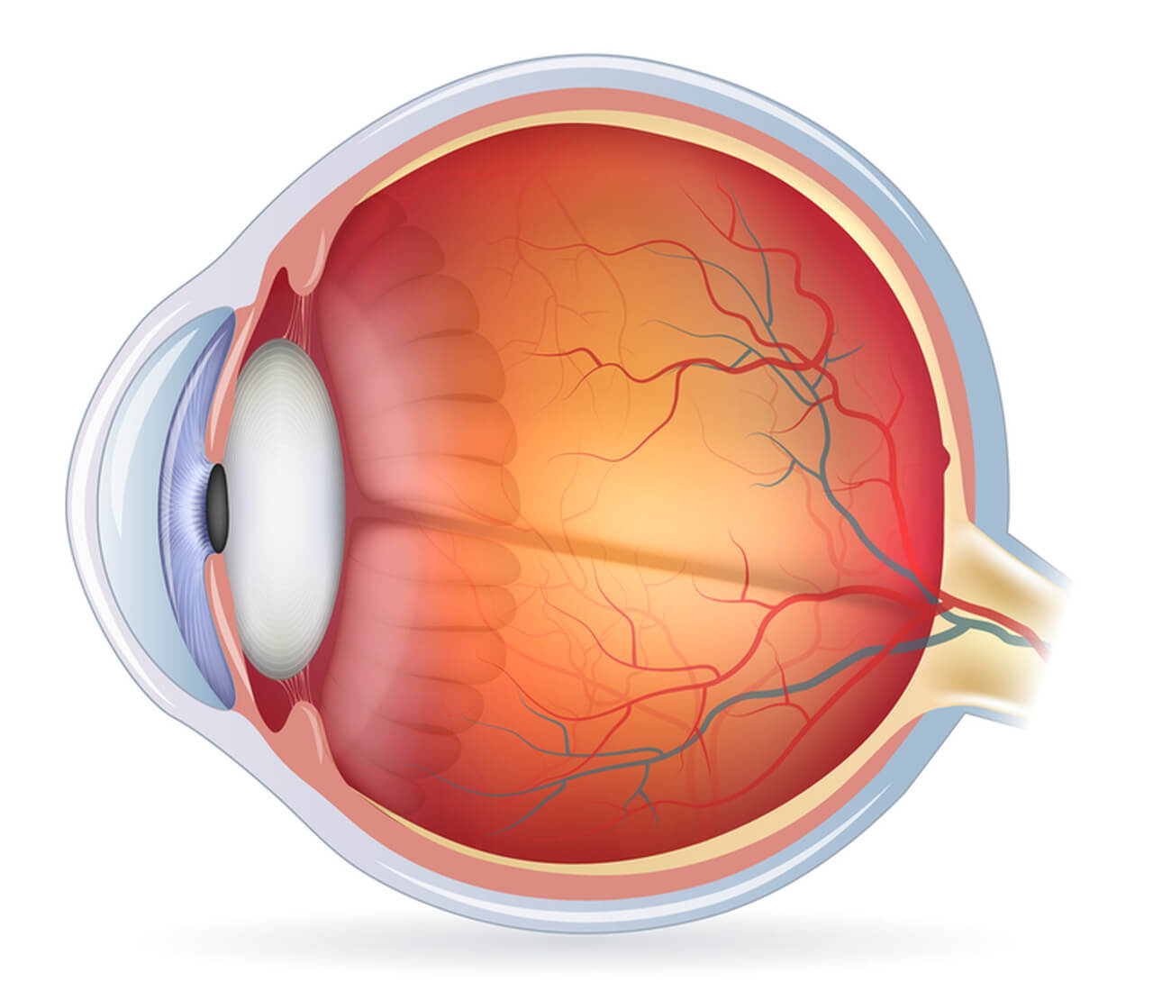 A imagem mostra uma ilustração do interior de um olho humano. É possível observar a retina, vasos sanguíneos e a estrutura interna do globo ocular, incluindo a córnea, lente e nervo óptico. Essa representação é frequentemente utilizada para explicar condições oftalmológicas ou realizar apresentações sobre a anatomia ocular.
