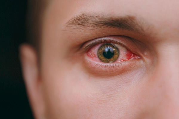 Retina - Hospital de Olhos